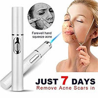 Thumbnail for Blue Light Therapy Acne Laser Pen Soft Scar Wrinkle Removal Treatment Device Skin Care Beauty Equipment